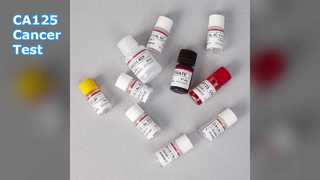Test CA125 ELISA pour la surveillance du cancer