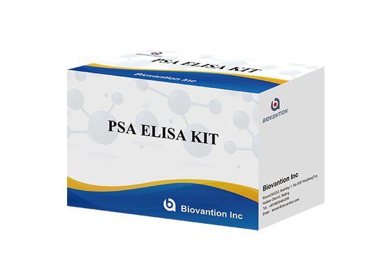 Kit de test Elisa pour l' antigène spécifique de la prostate du PSA total de haute précision