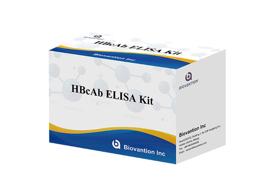 Analyse d'Elisa Test Enzyme Linked Immunosorbent d'analyse de sang de HBcAb
