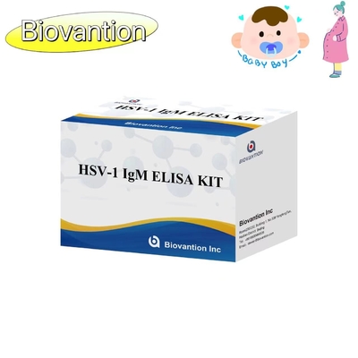 Kit de test ELISA à la torche HSV 1 IgM Réactif de diagnostic à haute vitesse IVD
