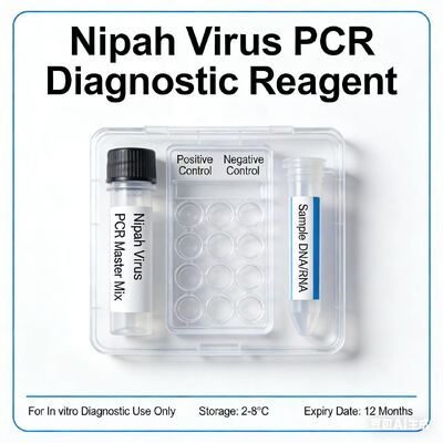 Nipah virus Real Time RT-PCR Kit swab, blood plasma, serum, cerebrospinal fluid