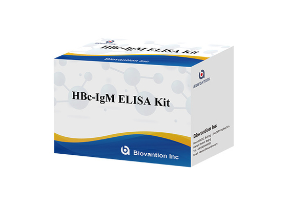 Essai d'Igm d'anticorps de noyau de Kit Hepatitis B d'essai d'ISO13485 HBc IgM