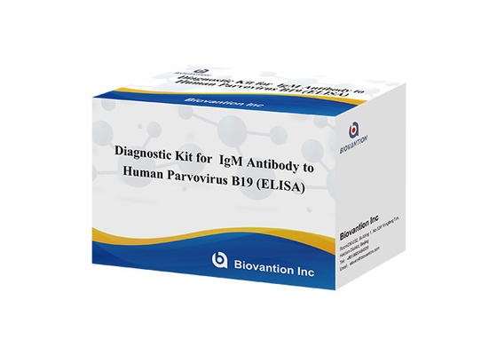 Anticorps contre le parvovirus humain B19 IgM