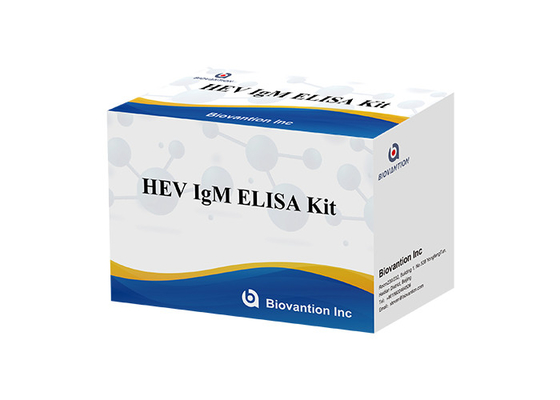Plasma de HEV IgM Elisa Test Kit Serum Vs pour la détection d'anticorps