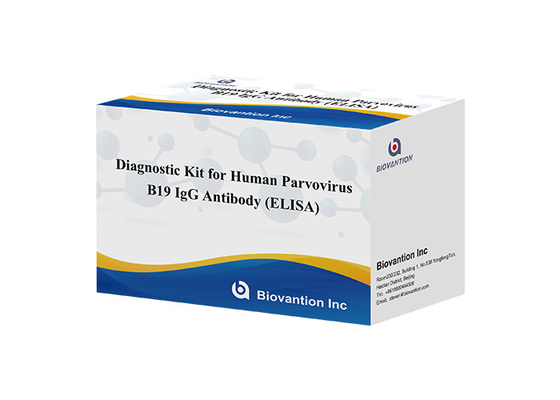 Kit de diagnostic pour le parvovirus humain B19 Kit de test IgG elisa Anticorps pour les échantillons de sérum