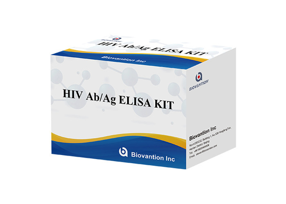 Analyse ELISA Kit de génération d'HIV 4ème d'essai d'ab AG d'HIV ISO13485 60 minutes