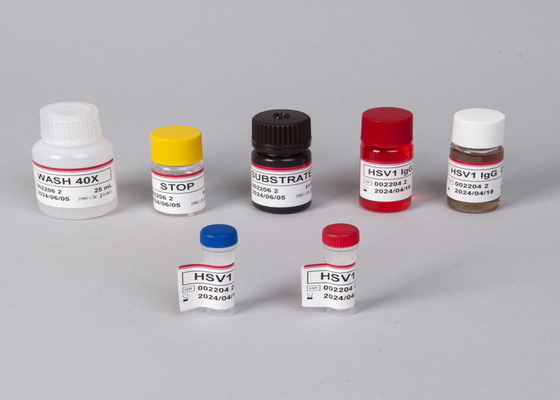 Kit de test ELISA pour les anticorps contre le virus de l'immunodéficience humaine (VIH)