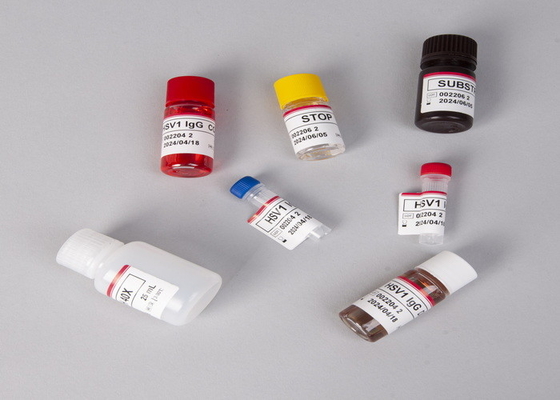 Pour le laboratoire ou l'hôpital, kit de test Elisa de gonadotrophine chorionique bêta-humaine à haute précision