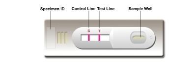 Autotest en laboratoire ou à l'hôpital Test rapide à haute précision Leishmania Ab Combo