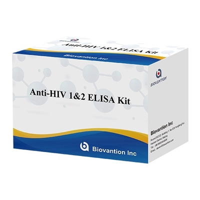 Kit de test Elisa pour le VIH Durée de conservation de 18 mois Test Elisa avec une sensibilité et une spécificité élevées