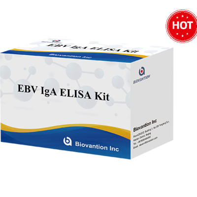 Kit de détection des tests immunologiques pour les lèvres EBV-VCA IgA Ab ELISA