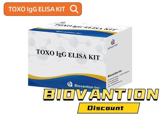 TOXO Ig G Kit de test Elisa sensible et spécifique pour la surveillance de la maladie