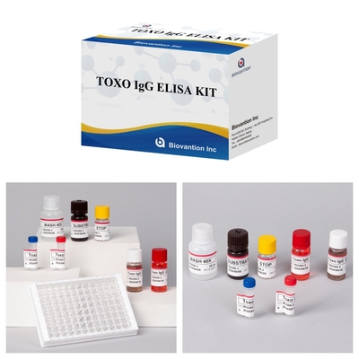 TOXO Ig G Kit de test Elisa sensible et spécifique pour la surveillance de la maladie