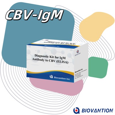 18 mois Délai de conservation Test d'analyse immunosorbant lié aux enzymes pour l' anticorps IgM contre le CBV