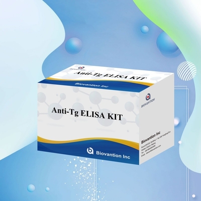 Kit de diagnostic Elisa pour les anticorps antithyroglobuline humaine anti-Tg pour les hôpitaux et les laboratoires