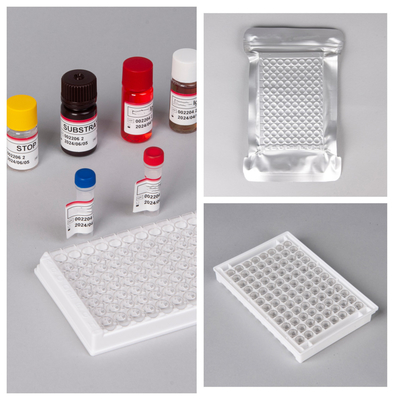 Tests de dépistage du VIH Ab Ag Elisa avec une durée de conservation de 18 mois et une sensibilité/spécificité élevée