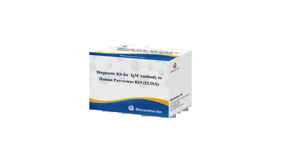 Kit de diagnostic pour le parvovirus humain B19 Kit de test IgG elisa Anticorps pour les échantillons de sérum