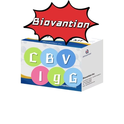 Kit de diagnostic pour le test ELISA des anticorps CBV-IgG