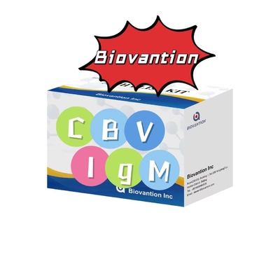 Kit de diagnostic pour l'anticorps IgM contre le VBC Kit de test Elisa 50 μL sérum Diagnostic médical