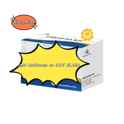 Kit de diagnostic pour l'anticorps IgM contre le VBC Kit de test Elisa 50 μL sérum Diagnostic médical