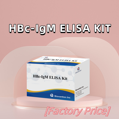 Test du réactif de diagnostic de l'anthégène HBc IgM de haute précision avec kit de test immunosorbant lié à l'enzyme
