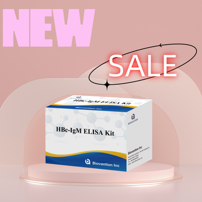 Test du réactif de diagnostic de l'anthégène HBc IgM de haute précision avec kit de test immunosorbant lié à l'enzyme