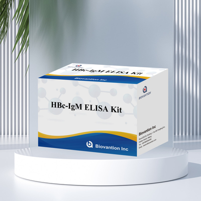 Test du réactif de diagnostic de l'anthégène HBc IgM de haute précision avec kit de test immunosorbant lié à l'enzyme