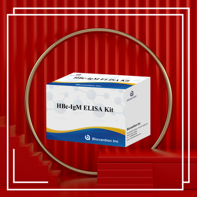 Test du réactif de diagnostic de l'anthégène HBc IgM de haute précision avec kit de test immunosorbant lié à l'enzyme