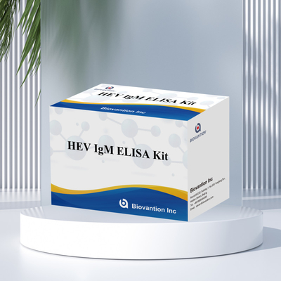 Kit de test Elisa précis et sensible HEV-IgM pour le diagnostic et l'analyse