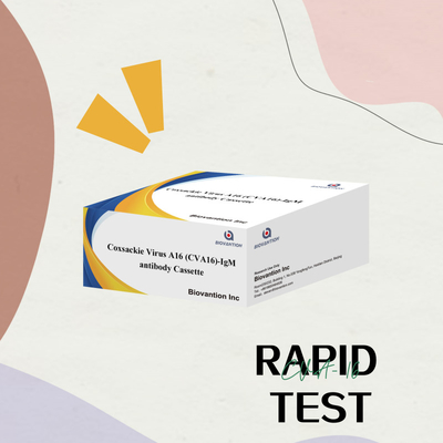 Réactif de diagnostic IVD CVA16 Virus de Coxsackie A16 CVA16-IgM Cassette d'anticorps WB/S/P Essai rapide en or colloïdal