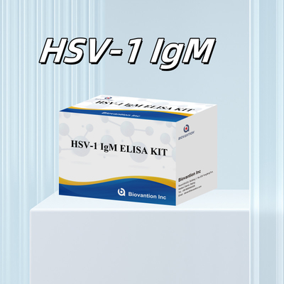 Diagnostic médical du VHS-1 IgM Kit de test Elisa avec une durée de conservation de 18 mois