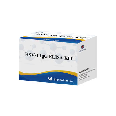 Kit d'immunothérapie à haute sensibilité pour le VHS-1 IgG pour la détection sérologique Type d'échantillon de plasma