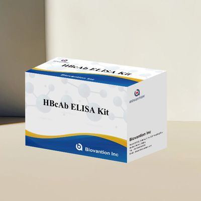Kit d'analyse d'anticorps pour le test ELISA HBcAb