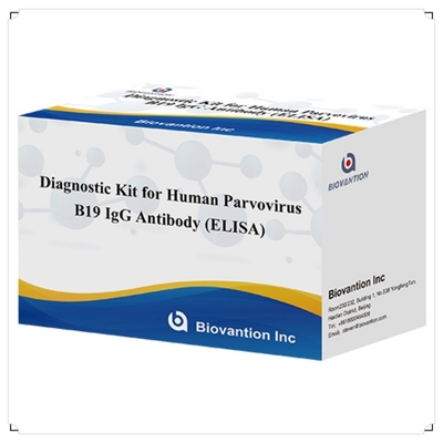 Kit de diagnostic à usage humain pour le parvovirus humain B19 IgM Anticorps Elisa Test Kit avec 96T