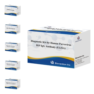 Kit de diagnostic à usage humain pour le parvovirus humain B19 IgM Anticorps Elisa Test Kit avec 96T