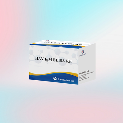 Kit de test HAV IgM ELISA Réactif de diagnostic humain
