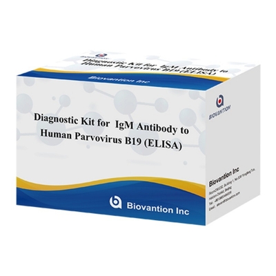 Kit de diagnostic pour le parvovirus humain B19 IgM ELISA d' anticorps idéal pour l' érythème infectieux et les complications pendant la grossesse