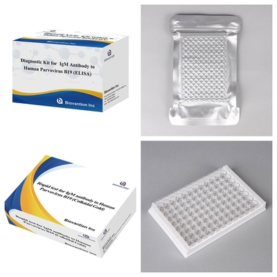 Kit de test ELISA avancé d'anticorps IgM contre le parvovirus humain B19 pour la détection et le dépistage de la grossesse
