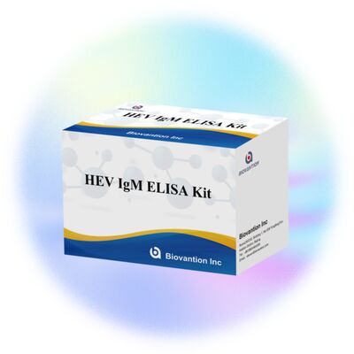 Kit de test ELISA IgM HEV à haute sensibilité avec taille 96T et temps d'essai de 2-3 heures pour un diagnostic précis