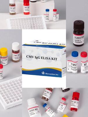 Kit de test Elisa IgG pour le CMV de haute précision en laboratoire ou à l'hôpital