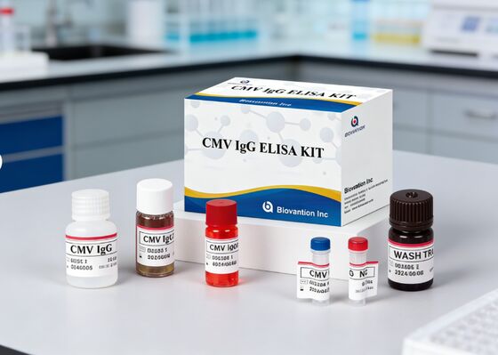 Kit de test Elisa IgG pour le CMV de haute précision en laboratoire ou à l'hôpital