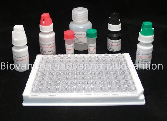 Hepatitis B Virus Surface Antigen ELISA Test Kit with 18 Months Shelf Life, High Sensitivity, and 2-3 Hours Assay Time